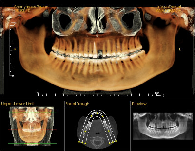 3D x-ray from Lakewood Dental Arts in Lakewood, CA