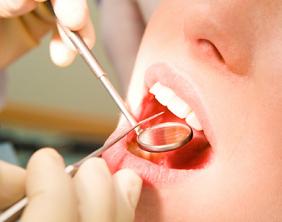 Common Dental Problems and How to Prevent Them